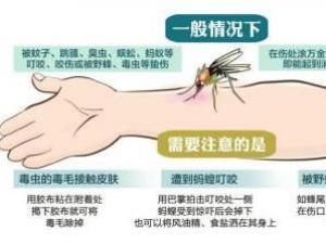 被毒蚊子咬了怎么辦？蚊子咬了怎么消腫止癢