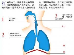 打嗝不止怎么辦？打嗝偏方