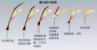 寧波薇琳整形醫(yī)院祛斑怎么樣？還您一張漂亮的容顏