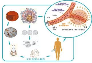 廣州復大腫瘤醫(yī)院牛立志教授：癌癥治療技術——血管介入療法