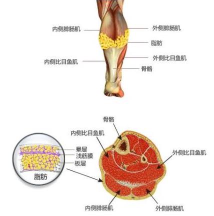 上海麗質美學整形門診部做瘦小腿價格貴嗎？肌肉小腿太難減怎么辦