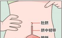 ?肚臍下面疼是怎么回事，肚臍下面疼是怎么回事男性